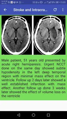 CT Brain Basic Interpretation android App screenshot 0