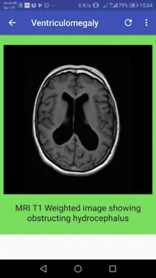 CT Brain Basic Interpretation android App screenshot 1