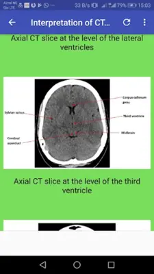 CT Brain Basic Interpretation android App screenshot 3